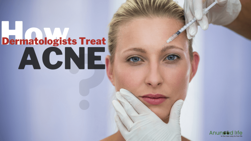 How Dermatologists Treat Acne?