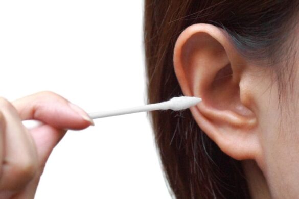 Ear-Wax-Removal