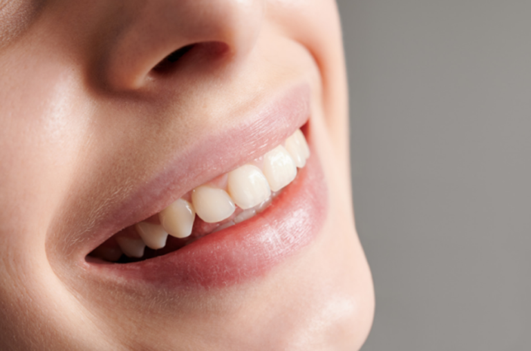 Teeth Whitening Treatments and Zoom Whitening